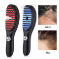 Hair Growth Comb Electric Anti Hair Loss Scalp Massager LED Red Blue Light Therapy Vibration Hair Massage Brush Electric Hair Growth Scalp Massager Comb Red & Blue LED Light Therapy Nano Mist Hair Oil Applicator USB Rechargeable Vibration Massage Comb15ml. 