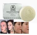 Dr. James Acne And Freckle Soap (Import From Thailand). 