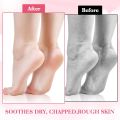 1-Pair Silicone Moisturizing Socks, Soft Silicone Socks For Cracked Feet Women And Men Foot Moisturiser Socks Foot Spa Pedicure Silicone Gel Socks For Cracked Feet Dry Skins Calluses. 