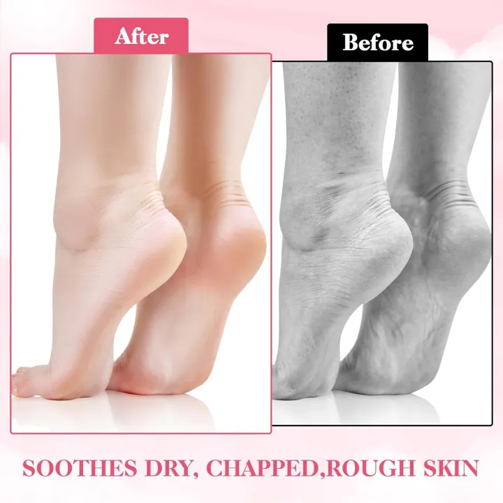 1-Pair%20Silicone%20Moisturizing%20Socks,%20Soft%20Silicone%20Socks%20For%20Cracked%20Feet%20Women%20And%20Men%20Foot%20Moisturiser%20Socks%20Foot%20Spa%20Pedicure%20Silicone%20Gel%20Socks%20For%20Cracked%20Feet%20Dry%20Skins%20Calluses%20-%20Image%207
