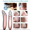Best quality Rechargeable Blackhead Remover XN-8030 Skin Care Expert Acne Pore Cleaner Electric Spot Machin.... 