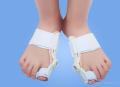 Foot Care Toe Bunion Splint Corrector Orthopedic Braces. 