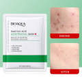 BIOAQUA Salicylic Acid Acne Removal Facial Sheet Mask. 