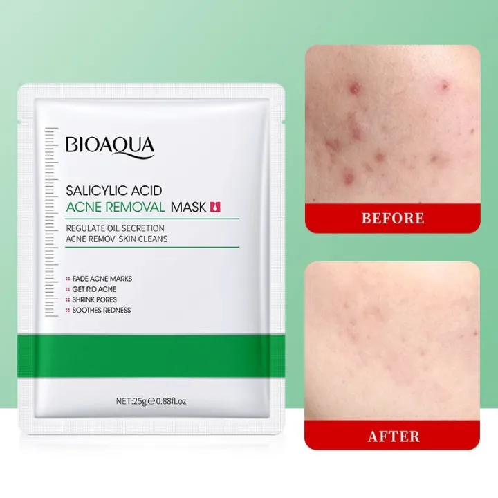 BIOAQUA%20Salicylic%20Acid%20Acne%20Removal%20Facial%20Sheet%20Mask%20-%20Image%202