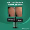 Markaway Advanced Stretch Mark Repair Serum Deep Hydration Formula Reduces Stretch Marks Restores Skin Elasticity and Improves Texture for Smooth Radiant Skin. 