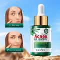 Sadoer Acnes Tea Tree Essence Oil & Face Serum 30ml. 