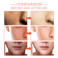FORT 5IN1 Whitening Serum | Brighten Skin Tone, Removes Dead Skin Whitening Serum | 30ML. 