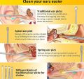 Ear Wax Cleaning Kit, 6 Pcs Ear Pick Tools, Wax Removal Kit, Ear Cleaning Tool Set, Spring Earwax Cleaner Tool Ear Wax Remover, Reusable Ear Cleaner for Children and Adult. 