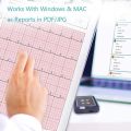 ViATOM Pulsebit-EX ECG Monitor, Heart Monitor w ECG, Bluetooth EKG Device with iOS & Android APP,, Personal Portable Heart Health Tracker Home. 