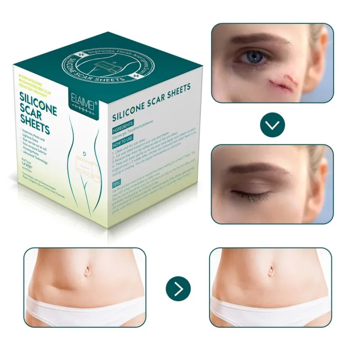 Tape%20Efficient%20Surgery%20Scar%20Removal%20Silicone%20Gel%20Sheet%20Therapy%20Patch%20-%20Image%206