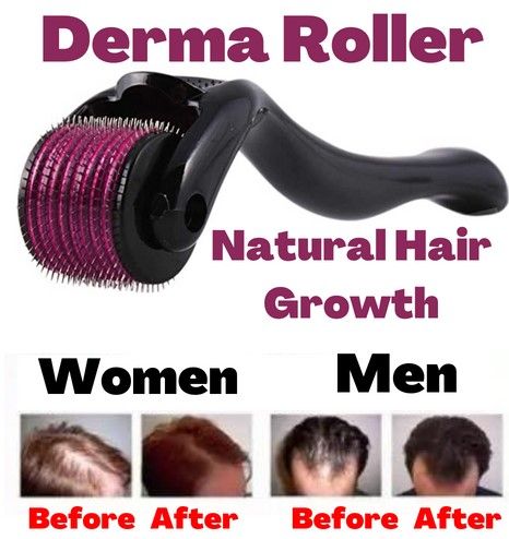 Derma roller 0.5mm with 540 Micro Needles - Derma Roller for Hair Growth - Derma Roller for Skin - Derma Roller for Face - Derma Roller for Hair | Daraz.pk