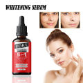 FORT 5IN1 Whitening Serum | Brighten Skin Tone, Removes Dead Skin Whitening Serum | 30ML. 
