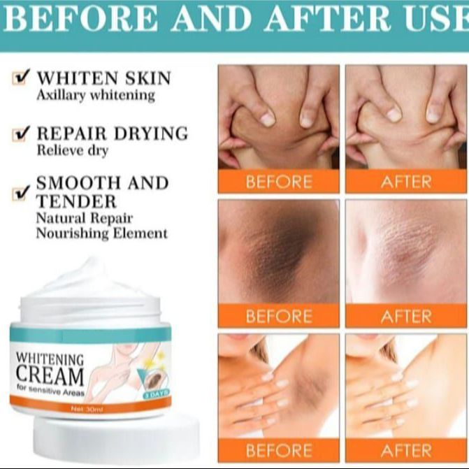 Whitening%20Cream%20for%20Sensitive%20Areas,%20Fragrance-Free,%2030ml%20-%20Smooth%20Skin%20Nourishing%20Intimate%20Care%20-%20Image%206