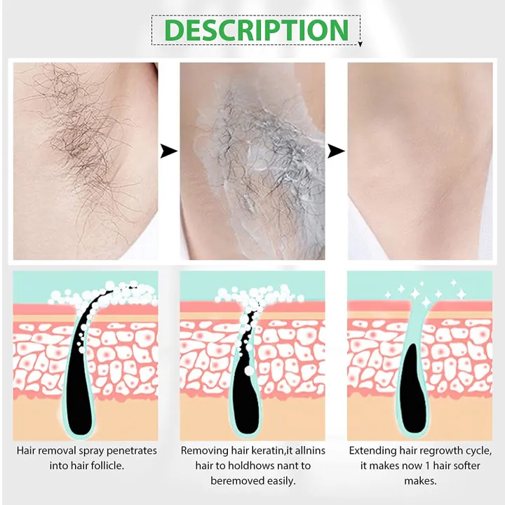 Hair%20Remover%20Spray%20For%20Men%20and%20Women-300ml%20-%20Image%205