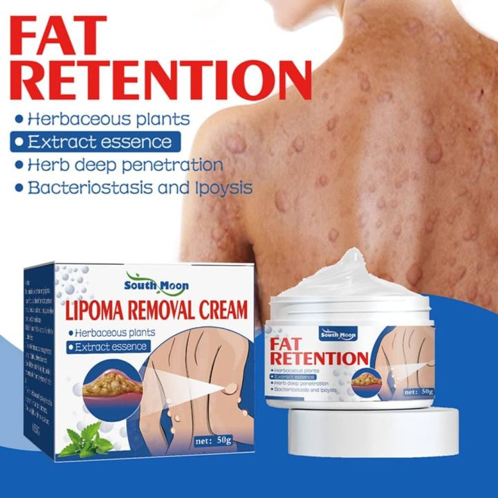 Lipo-PRO Lipoma Remover Cream | Easy At-Home Lipoma Care | Daraz.pk