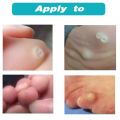 CORN CAP (Foot Care) 5PCS. 
