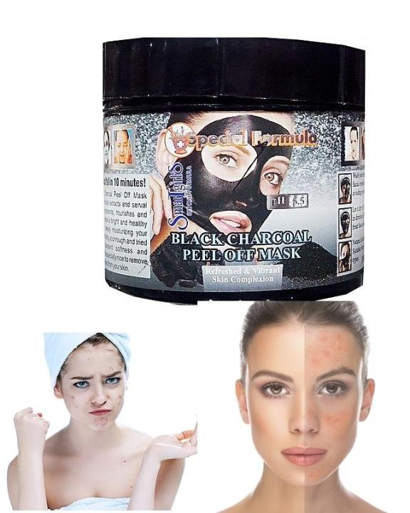 Charcoal%20Acne%20Blackhead%20Peel-Off%20Mask%20For%20Acne%20Skin%20-%20150%20Ml%20-%20Image%205