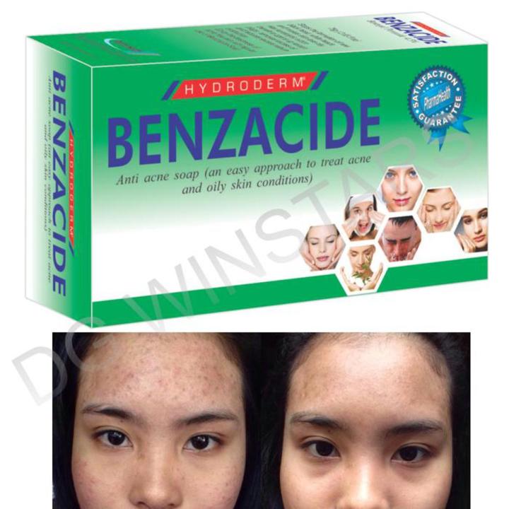 Benzoyl Peroxide Salicylic Acid Acne Act Medicated Soap For Acne Oily Skin
