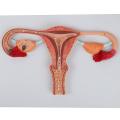 Human Fertilization Process Model, Features Cross-Section of Uterus, Ovaries, and Fallopian Tubes with Gametes | Embryology Teaching Model. 