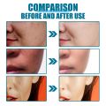 Bioaqua Rice Face Sleeping Mask Moisturizing Lightening Face Lifting Smooth Centella Facial Jelly Masks Korean Cosmetics4ML*5pcs. 