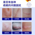 German brand silicone scar cream scar removal cream medical grade to remove old scars, burn scars, a wipe of anti-ointment genuine. 