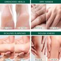 Urea 42% Cream For Dry Cracked Feet Heels Hands Body Repairing Treatments Deeply Moisturizing Callus Dead Skin Remove Foot Care. 