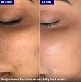 Dermive Hydrating Serum. 