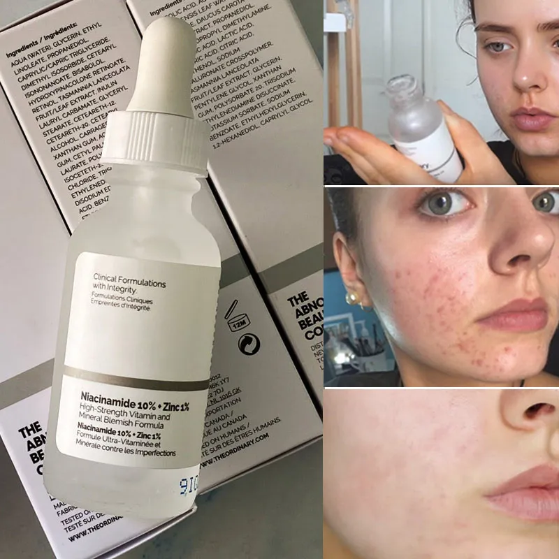 Original Niacinamide 10% + Zinc 1% Skin Care Serum Vitamin And Mineral Blemish Formula Oil Control Whitening Hydration Essence | Daraz.pk