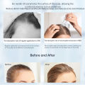 Authentic 120Pins Reusable Derma Stamp For Hair Growth Adjustable Length 0-2mm Microneedling Face Skincare. 