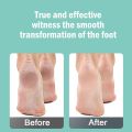 Finishing Touch Flawless Pedi Electronic Tool File and Callus Remover Pedicure Foot Scubber Pedicure Scrubber For Feet Remove Dead Hard Skin Foot File. 