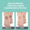 Finishing Touch Flawless Pedi Electronic Tool File and Callus Remover Pedicure Foot Scubber Pedicure Scrubber For Feet Remove Dead Hard Skin Foot File. 