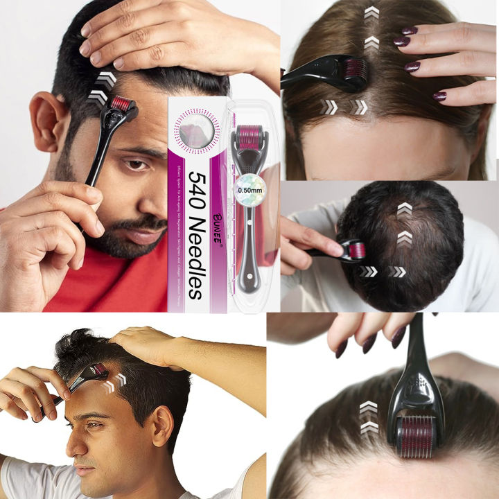 Derma%20Roller%200.5%20Mm%20Hair%20&%20Skin%20System%20with%207%20days%20ginger%20germinal%20oil%20-%20Image%203