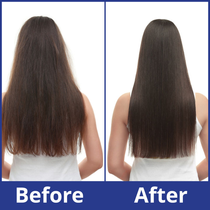 WBM%20Belux%20Anti%20Hair%20Loss%20Shampoo%20-%20400%20ml%20%7C%20Shampoo%20for%20Hair%20Growth%20-%20Image%204