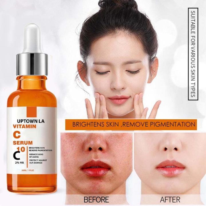 Uptown LA Vitamin C Brightening Serum for Face – Anti Aging Face Serum  – Brightening Serum for Dark Spots, Even Skin Tone, Eye Area, Fine Lines & Wrinkles for all skin types 30  ml