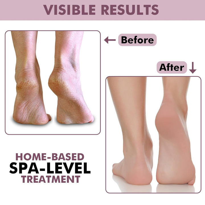 Moisturizing%20Socks%20Silicone%20Gel%20Spa%20Exfoliating%20Socks%20for%20Dry%20Cracked%20Skin%20Heel%20Socks%20Anti%20Slip%20for%20Foot%20Care%20Softening%20Calluses%20-%20Image%205