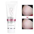 Stretch Marks Scar Removal Maternity Skin Body Repair Cream. 