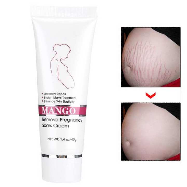 Stretch%20Marks%20Scar%20Removal%20Maternity%20Skin%20Body%20Repair%20Cream%20-%20Image%205