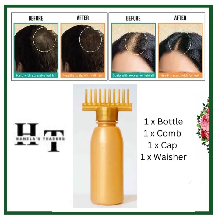 Hair%20Oil%20Bottle%20With%20Comb%20%7C%20Best%20For%20Dandruff%20&%20Hair%20Fall%20%7C%20Anti%20Lice%20Comb%20%7C%20Imported%20Multipurpose%20Applicator%20%7C%20-%20Image%203