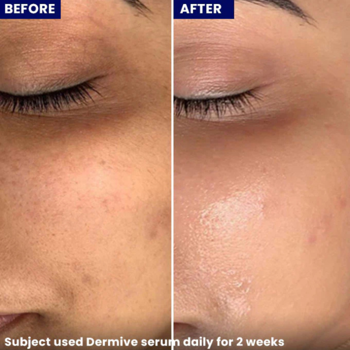 Dermive%20Hydrating%20Serum%20with%20Snail%20Mucin,%20Hyaluronic%20Acid,%20Ceramides%20&%20Alpha%20Arbutin%20%7C%20Deep%20Hydration,%20Barrier%20Repair,%20Anti-Aging%20&%20Dark%20Spot%20Removal%20%7C%2030ml%20-%20Image%207