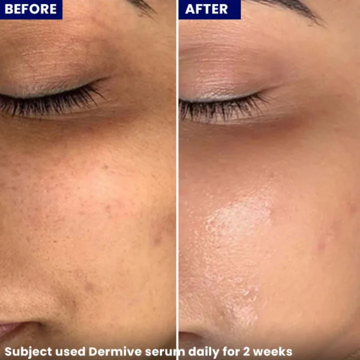 Dermive%20Hydrating%20Serum%20with%20Snail%20Mucin,%20Hyaluronic%20Acid,%20Ceramides%20&%20Alpha%20Arbutin%20%7C%20Deep%20Hydration,%20Barrier%20Repair,%20Anti-Aging%20&%20Dark%20Spot%20Removal%20%7C%2030ml%20-%20Image%207