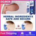 20g Instant Blemish Removal Gel Wart Removal Body Warts Treatment Cream Foot Care Cream Skin Tag Remover Wart Cream. 