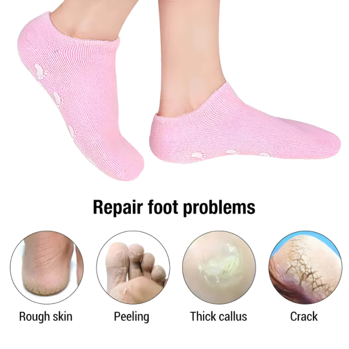 Moisturizing%20Gel%20Socks%20Feet%20Care%20Gel%20Spa%20Socks%20Foot%20Moisturizer%20Silicone%20Socks%20Non%20Slip%20Heel%20Socks%20for%20Dry%20Cracked%20Feet%20Overnight%20Lotion%20Socks%20for%20Women%20Men%20Softening%20Feet%20Rough%20Skin%20-%20Image%204