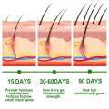 Rosemary Essential Oil Hair Growth Oils Pure Natural 30ML Hair Essential Oils For Nourish Shiny Hair Healthy Hair Care. 