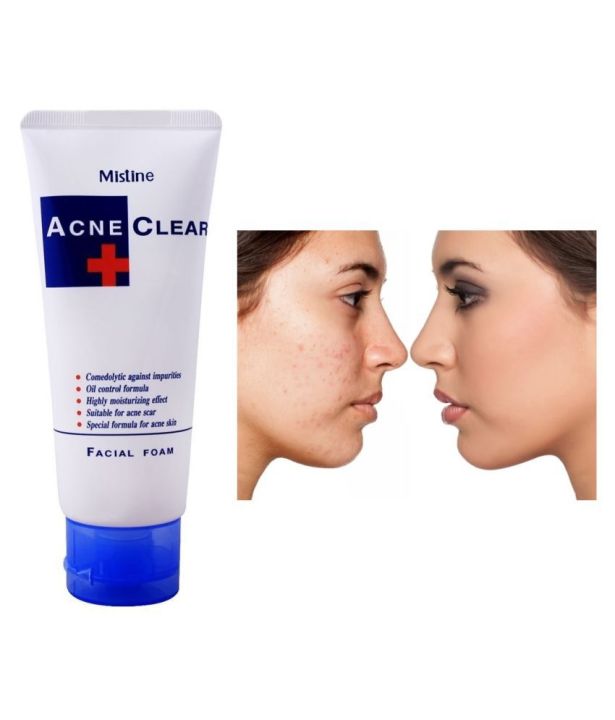 Mistine%20Acne%20Clear%20Face%20Wash%20Facial%20Foam%2085%20ml%20-%20Image%206
