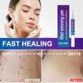 Skin Tag eye Wart Mole Remover Pen Woman Skin Care Removing Against Moles Pimple Patch Remove Black Dot. 
