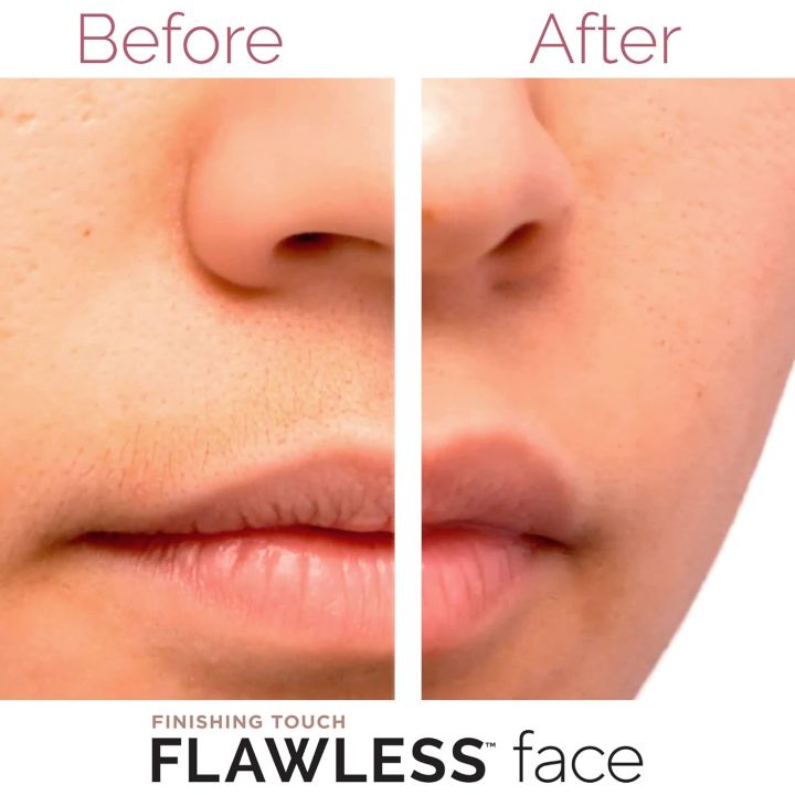 Flawless%20Hair%20Remover%20Hair%20Remover%20Trimmer%20For%20Women%20Facial%20Hair%20Removal%20for%20Women%20Tech%20Painless%20Hair%20Remover%EF%BC%8CWaterproof%20Shaver%20Razor%20Hair%20Remover%20with%20LED%20Light%20for%20Face%20Bikini%20Peach%20Fuzz%20Upper%20Mustache%20Lip%20Chin(White)%20-%20Image%203