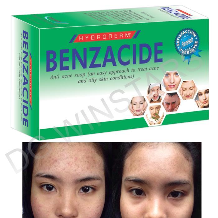 Benzoyl%20Peroxide%20Salicylic%20Acid%20Acne%20Act%20Medicated%20Soap%20For%20Acne%20Oily%20Skin%20-%20Image%202