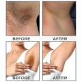 Quickly Private Parts Whitening Cream Bikini Area Brightening Cream Body Underarm Bleaching Emulsion Women Intimate Area Care. 