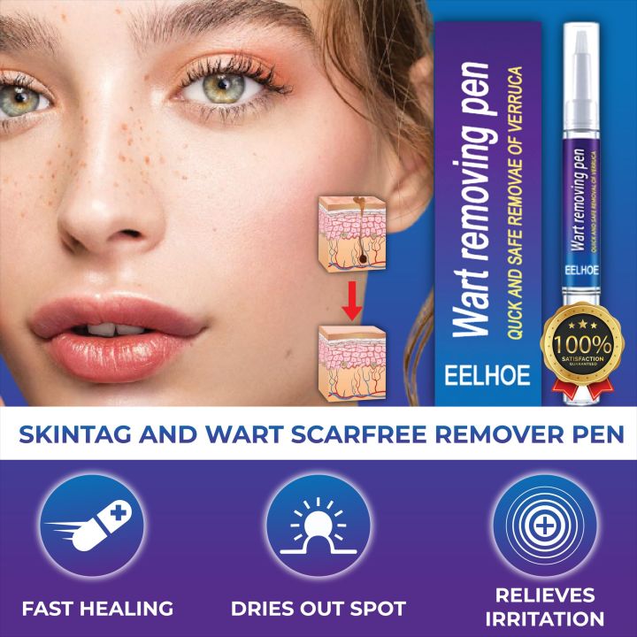 Eelhoe Wart Removing Pen Anti Wart Pen, Effective for Common Warts, Flat Warts, and Plantar Warts, Fast Acting Non Irritating Easy To Use Safe and Gentle