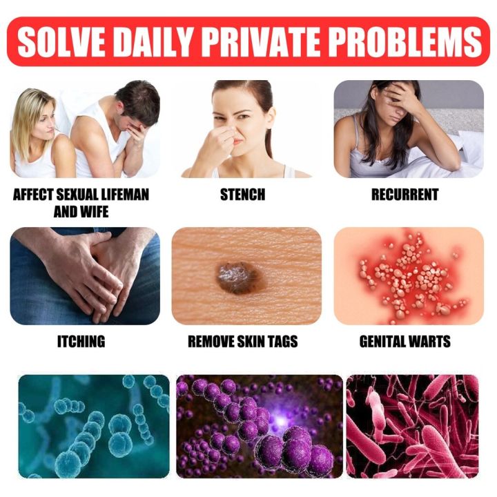 South%20Moon%20Wart%20Removing%20Ointment%20Anti%20Warts%20Ointment%20Hands%20Axillary%20Meat%20Particles%20Neck%20Filamentous%20Smooth%20Wart%20Remover%20Cream%20-%20Image%205